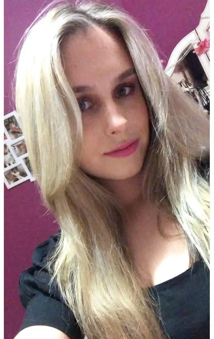 Juliane com queimaduras